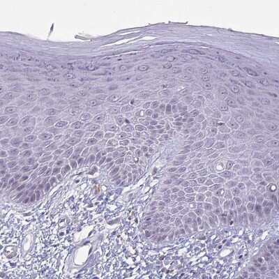 Immunohistochemistry-Paraffin: CNGB3 Antibody [NBP2-58445] - Staining of human skin shows no positivity in squamous epithelial cells as expected.