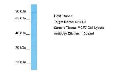 Western Blot: CNGB3 Antibody [NBP2-84702] - Host: Rabbit. Target Name: CNGB3. Sample Type: MCF7 Whole Cell lysates. Antibody Dilution: 1.0ug/ml