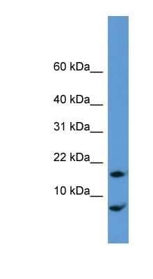 Western Blot: CNIH Antibody [NBP1-68915] - Rat Lung lysate, concentration 0.2-1 ug/ml.