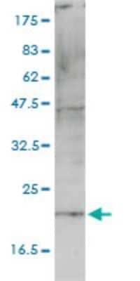 Western Blot: CNIH4 Antibody (4E10-1G4) [H00029097-M01] - HSPC163 monoclonal antibody (M01), clone 4E10-1G4 Analysis of HSPC163 expression in A-431.