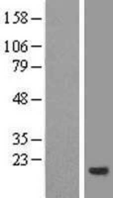 Western Blot: CNIH4 Overexpression Lysate (Adult Normal) [NBL1-09312] Left-Empty vector transfected control cell lysate (HEK293 cell lysate); Right -Over-expression Lysate for CNIH4.