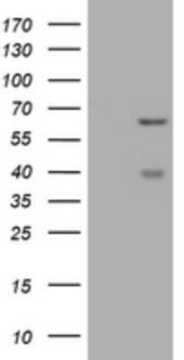 Western Blot: CNKSR3 Antibody (OTI1D7) - Azide and BSA Free [NBP2-72428] - Analysis of HEK293T cells were transfected with the pCMV6-ENTRY control (Left lane) or pCMV6-ENTRY CNKSR3.