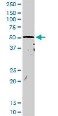 Western Blot: CNKSR3 Antibody [H00154043-D01P] - Western Blot analysis of CNKSR3 expression in mouse liver.