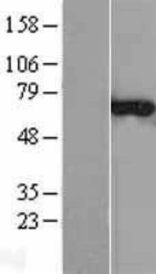 Western Blot: CNKSR3 Overexpression Lysate (Adult Normal) [NBL1-09313] Left-Empty vector transfected control cell lysate (HEK293 cell lysate); Right -Over-expression Lysate for CNKSR3.