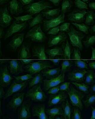 Immunocytochemistry/Immunofluorescence: CNNM1 Antibody [NBP3-15497] - Immunofluorescence analysis of U-2 OS cells using CNNM1 antibody (NBP3-15497) at dilution of 1:100. Blue: DAPI for nuclear staining.