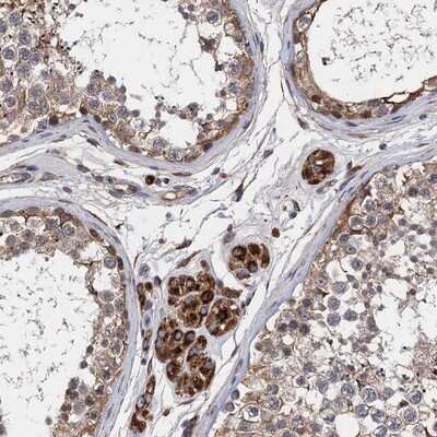 Immunohistochemistry-Paraffin CNNM1 Antibody