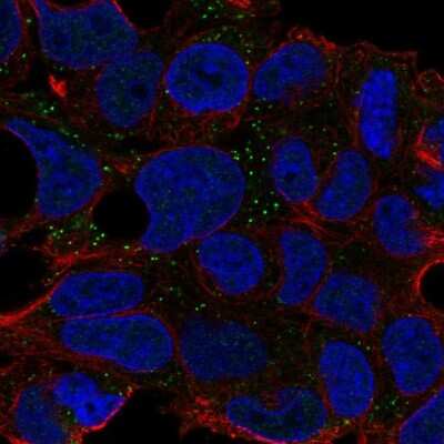 Immunocytochemistry/Immunofluorescence: CNNM2 Antibody [NBP2-57391] - Staining of human cell line Hep G2 shows localization to vesicles. Antibody staining is shown n green.