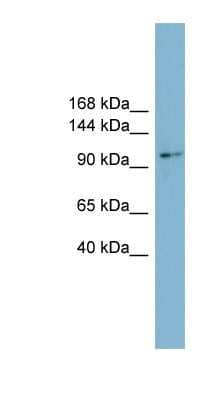 Western Blot: CNNM2 Antibody [NBP1-70502] - HT1080 cell lysate, concentration 0.2-1 ug/ml.