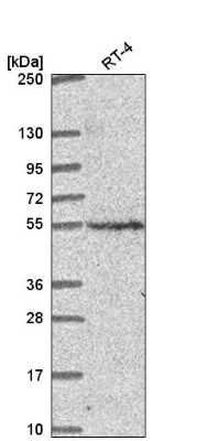 Western Blot: CNNM2 Antibody [NBP2-57086] - Analysis in human cell line RT-4.