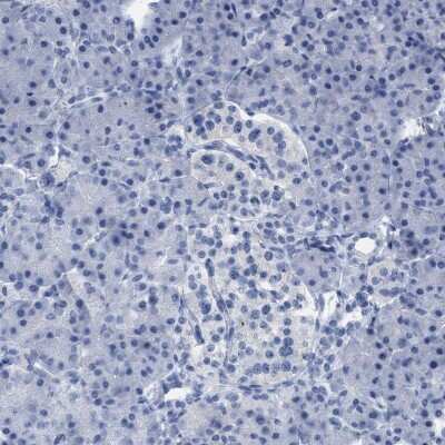 Immunohistochemistry-Paraffin CNNM4 Antibody