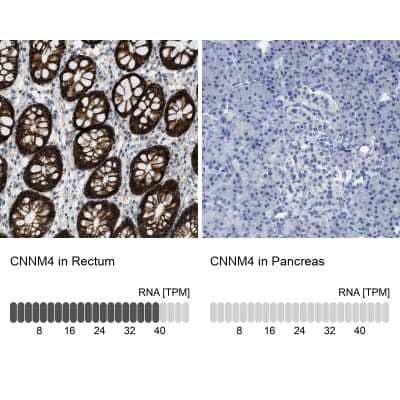 Immunohistochemistry-Paraffin CNNM4 Antibody