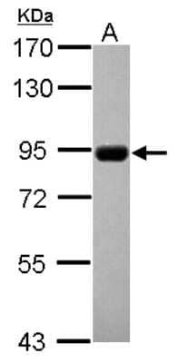 Western Blot: CNNM4 Antibody [NBP2-15927] - Sample (30 ug of whole cell lysate) A: U87-MG 7. 5% SDS PAGE gel, diluted at 1:1000.