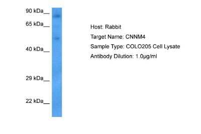 Western Blot: CNNM4 Antibody [NBP2-87198] - Host: Rabbit. Target Name: CNNM4. Sample Tissue: Human COLO205 Whole Cell lysates. Antibody Dilution: 1ug/ml