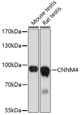 Western Blot: CNNM4 Antibody [NBP2-92636] - Analysis of extracts of various cell lines, using CNNM4 at 1:1000 dilution.Secondary antibody: HRP Goat Anti-Rabbit IgG (H+L) at 1:10000 dilution.Lysates/proteins: 25ug per lane.Blocking buffer: 3% nonfat dry milk in TBST.Detection: ECL Basic Kit .Exposure time: 90s.