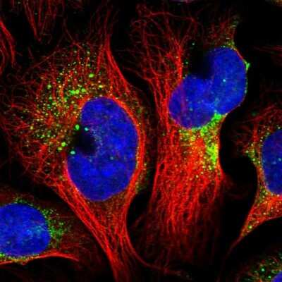 Immunocytochemistry/Immunofluorescence: CNO Antibody [NBP1-91798] - Immunofluorescent staining of human cell line U-2 OS shows localization to vesicles.