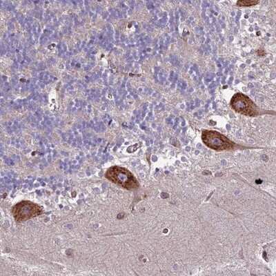 Immunohistochemistry-Paraffin: CNO Antibody [NBP1-91798] - Staining of human cerebellum shows strong cytoplasmic positivity in Purkinje cells.
