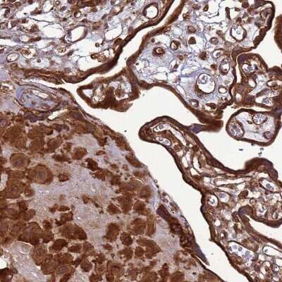 Immunohistochemistry: CNOT1 Antibody [NBP2-32045] - Staining of human placenta shows strong cytoplasmic positivity in trophoblastic cells and decidua cells.