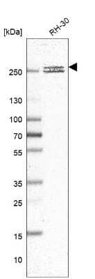 Western Blot: CNOT1 Antibody [NBP2-31892] - Analysis in human cell line RH-30.