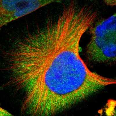 Immunocytochemistry/Immunofluorescence: CNOT3 Antibody [NBP1-82971] - Immunofluorescent staining of human cell line U-251 MG shows localization to cytosol.