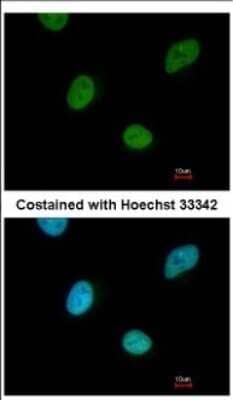 Immunocytochemistry/Immunofluorescence: CNOT3 Antibody [NBP2-15928] - Immunofluorescence analysis of paraformaldehyde-fixed HeLa, using antibody at 1:200 dilution.