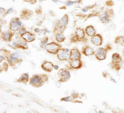 Immunohistochemistry-Paraffin: CNOT3 Antibody [NBP1-21396] - Human testicular seminoma. Antibody used at a dilution of 1:200 (1ug/ml).