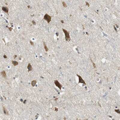 Immunohistochemistry-Paraffin: CNOT3 Antibody [NBP1-82971] - Staining of human cerebral cortex shows strong cytoplasmic positivity in neuronal cells.