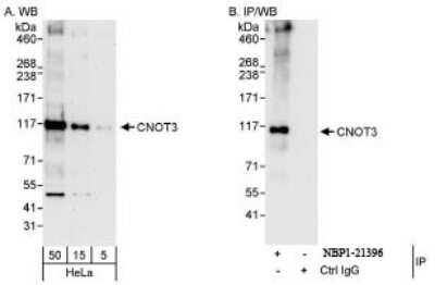 Western Blot CNOT3 Antibody