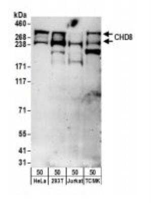 <b>Biological Strategies Validation. </b>Western Blot: CNOT3 Antibody [NBP1-21396] - Whole cell lysate (50 ug) from HeLa, 293T, Jurkat, and   mouse TCMK-1 cells.