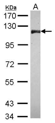 Western Blot: CNOT3 Antibody [NBP2-15928] - Sample (30 ug of whole cell lysate) A: IMR32 7. 5% SDS PAGE gel, diluted at 1:3000.