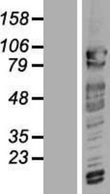 Western Blot: CNOT3 Overexpression Lysate (Adult Normal) [NBL1-09318] Left-Empty vector transfected control cell lysate (HEK293 cell lysate); Right -Over-expression Lysate for CNOT3.