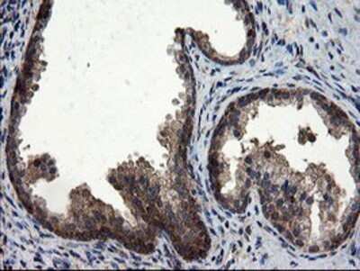 Immunohistochemistry: CNOT4 Antibody (OTI1H2) - Azide and BSA Free [NBP2-71212] - Staining of paraffin-embedded Human prostate tissue using anti-CNOT4 mouse monoclonal antibody.