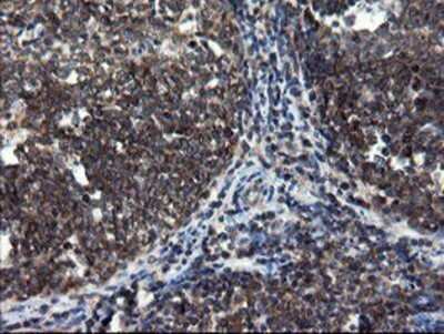 Immunohistochemistry: CNOT4 Antibody (OTI1H2) - Azide and BSA Free [NBP2-71212] - Staining of paraffin-embedded Human tonsil using anti-CNOT4 mouse monoclonal antibody.