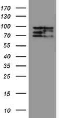 Western Blot: CNOT4 Antibody (OTI1H2) - Azide and BSA Free [NBP2-71212] - HEK293T cells were transfected with the pCMV6-ENTRY control (Left lane) or pCMV6-ENTRY CNOT4 (Right lane) cDNA for 48 hrs and lysed. Equivalent amounts of cell lysates (5 ug per lane) were separated by SDS-PAGE and immunoblotted with anti-CNOT4.