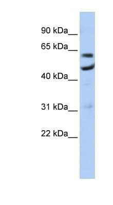 Western Blot CNOT6 Antibody