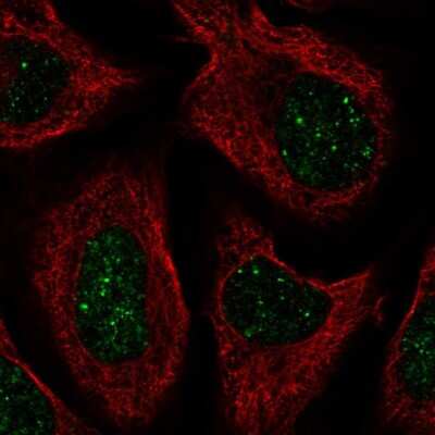 Immunocytochemistry/Immunofluorescence: CNOT7 Antibody [NBP2-57301] - Staining of human cell line U-2 OS shows localization to nuclear bodies.