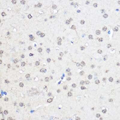 Immunohistochemistry-Paraffin: CNOT7 Antibody [NBP2-92571] - Immunohistochemistry of paraffin-embedded Mouse brain using CNOT7 Rabbit pAb (NBP2-92571) at dilution of 1:50 (40x lens). Perform microwave antigen retrieval with 10 mM PBS buffer pH 7.2 before commencing with IHC staining protocol.