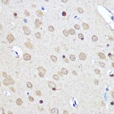 Immunohistochemistry-Paraffin: CNOT7 Antibody [NBP2-92571] - Immunohistochemistry of paraffin-embedded Rat brain using CNOT7 Rabbit pAb (NBP2-92571) at dilution of 1:50 (40x lens). Perform microwave antigen retrieval with 10 mM PBS buffer pH 7.2 before commencing with IHC staining protocol.