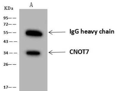 Immunoprecipitation: CNOT7 Antibody [NBP3-12705] - Lane A:0.5 mg RT-4 Whole Cell Lysate4 uL anti-CNOT7 rabbit polyclonal antibody and 60 ug of Immunomagnetic beads Protein A/G.Primary antibody:Anti-CNOT7 rabbit polyclonal antibody,at 1:100 dilution Secondary antibody:Goat Anti-Rabbit IgG (H+L)/HRP at 1/10000 dilutionDeveloped using the ECL technique.Performed under reducing conditions.Predicted band size: 33 kDaObserved band size :33 kDa