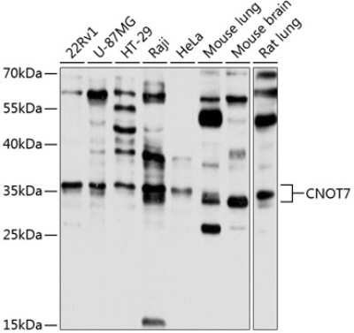 Western Blot: CNOT7 Antibody [NBP2-92571] - Analysis of extracts of various cell lines, using CNOT7 at 1:1000 dilution.Secondary antibody: HRP Goat Anti-Rabbit IgG (H+L) at 1:10000 dilution.Lysates/proteins: 25ug per lane.Blocking buffer: 3% nonfat dry milk in TBST.Detection: ECL Basic Kit .Exposure time: 5s.