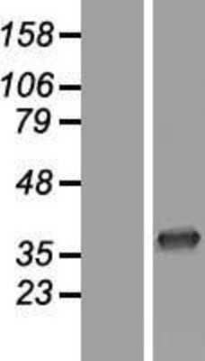 Western Blot: CNOT7 Overexpression Lysate (Adult Normal) [NBL1-09320] Left-Empty vector transfected control cell lysate (HEK293 cell lysate); Right -Over-expression Lysate for CNOT7.