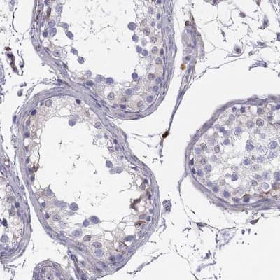 Immunohistochemistry-Paraffin: CNOX Antibody [NBP1-88152] - Staining of human testis shows moderate membranous positivity in subset of cells in seminiferous ducts.