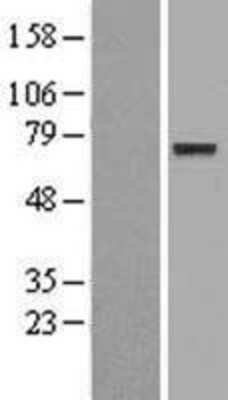 Western Blot: CNOX Overexpression Lysate (Adult Normal) [NBL1-10271] Left-Empty vector transfected control cell lysate (HEK293 cell lysate); Right -Over-expression Lysate for CNOX.