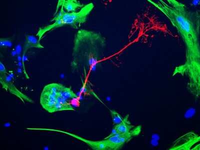 Immunocytochemistry/Immunofluorescence: CNPase Antibody (3H5) [NBP2-50044] - Mixed neuron-glial cell cultures stained with NBP2-50044 (red) and rabbit polyclonal antibody against GFAP (green, NB300-141). CNP stains strongly in oligodentrocytes, whereas GFAP labels only the intermediate filament in astrocytes. Blue is DNA staining.