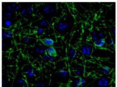 Immunohistochemistry-Frozen: CNPase Antibody [NB110-93362] - Staining of saline treated mouse cortex cryosections with CNPase antibody (green). Cell nuclei are visualized with DAPI DNA stain (blue).