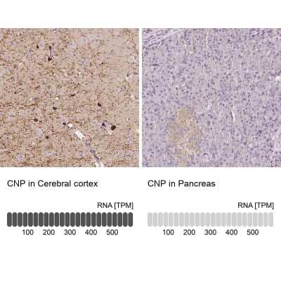 <b>Independent Antibodies Validation and Orthogonal Strategies Validation.</b>Immunohistochemistry-Paraffin: CNPase Antibody [NBP1-85998] - Staining in human cerebral cortex and pancreas tissues using anti-CNP antibody. Corresponding CNP RNA-seq data are presented for the same tissues.