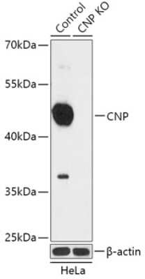 Knockout Validated: CNPase Antibody [NBP3-03492] - Analysis of extracts from normal (control) and CNP knockout (KO) HeLa cells, using CNPase antibody at 1:1000 dilution. Secondary antibody: HRP Goat Anti-Rabbit IgG (H+L) at 1:10000 dilution. Lysates/proteins: 25ug per lane. Blocking buffer: 3% nonfat dry milk in TBST.