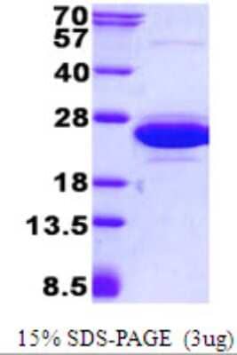 SDS-PAGE Recombinant Human CNRIP1 His Protein