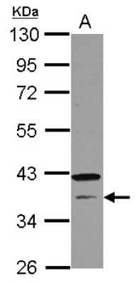 Western Blot: CNTD Antibody [NBP2-15932] - Sample (30 ug of whole cell lysate) A: NT2D1 10% SDS PAGE gel, diluted at 1:3000.