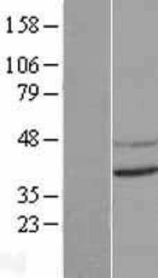 Western Blot: CNTD Overexpression Lysate (Adult Normal) [NBL1-09330] Left-Empty vector transfected control cell lysate (HEK293 cell lysate); Right -Over-expression Lysate for CNTD.