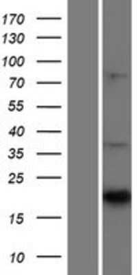 Western Blot: CNTF Overexpression Lysate (Adult Normal) [NBP2-09006] Left-Empty vector transfected control cell lysate (HEK293 cell lysate); Right -Over-expression Lysate for CNTF.